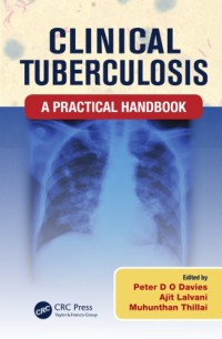 Clinical tuberculosis: a practical handbook