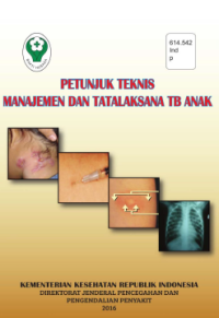 Petunjuk Teknis Manajemen dan Tatalaksana TB Anak